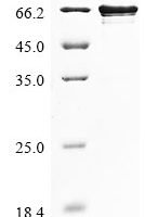 Human La-related protein 6 (LARP6) Recombinant Protein, N-His - BioCrest Sci