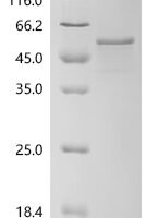 Human Pancreatic lipase-related protein 3 (PNLIPRP3) Recombinant Protein - BioCrest Sci