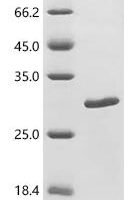 Mouse Neuronal acetylcholine receptor subunit alpha-7 (Chrna7), partial Recombinant Protein, N-10His - BioCrest Sci