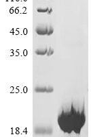 Mouse Sushi, von Willebrand factor type A, EGF and pentraxin domain-containing protein 1 (Svep1), partial Recombinant Protein, C-His, aa 2140–2260, Mammalian cell - BioCrest Sci