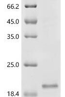 Human Sodium-dependent phosphate transport protein 3 (SLC17A2), partial Recombinant Protein - BioCrest Sci