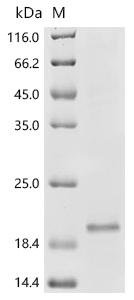 Human Sodium-dependent phosphate transport protein 3 (SLC17A2), partial Recombinant Protein, Homo sapiens (Human), E.coli, C-terminal 6xHis-tagged, 17.5 kDa, purity >≥ 85% as determined by SDS-PAGE.