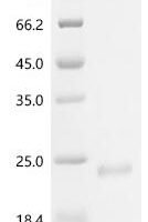 Rat Sodium-dependent phosphate transport protein 2B (Slc34a2), partial Recombinant Protein - BioCrest Sci