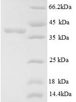 Human E3 ubiquitin-protein ligase MIB1 (MIB1), partial Recombinant Protein, N-His - BioCrest Sci