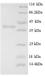 Human E3 ubiquitin-protein ligase MIB1 (MIB1), partial Recombinant Protein, N-His, Homo sapiens (Human), E.coli, N-terminal 6xHis-tagged, 40.1 kDa, purity >≥ 90% as determined by SDS-PAGE.