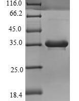 Human Complement C4-B (C4B), partial Recombinant Protein, N-His - BioCrest Sci