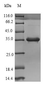 Human Complement C4-B (C4B), partial Recombinant Protein, N-His, Homo sapiens (Human), Yeast, N-terminal 6xHis-tagged, 35.1 kDa, purity >≥ 90% as determined by SDS-PAGE.