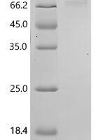 Human Interleukin-1 receptor-like 1 (IL1RL1), partial Recombinant Protein - BioCrest Sci