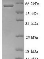 Human Ryanodine receptor 1 (RYR1), partial Recombinant Protein, N-His - BioCrest Sci