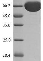 Human Fibroblast growth factor receptor 1 (FGFR1), partial Recombinant Protein, N-His-SUMOstar - BioCrest Sci