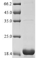 Pig Alpha-synuclein (SNCA) Recombinant Protein, N-His - BioCrest Sci