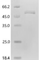 Bovine SPARC (SPARC) Recombinant Protein - BioCrest Sci