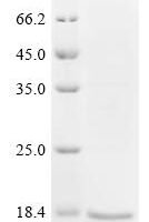 Mouse Superoxide dismutase [Cu-Zn] (Sod1) Recombinant Protein - BioCrest Sci