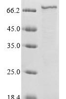 Human respiratory syncytial virus A Fusion glycoprotein F0 (F), partial Recombinant Protein, N-His-B2M - BioCrest Sci