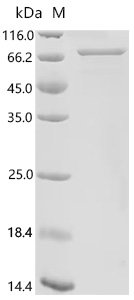 Human herpesvirus 2 Tegument protein VP16 (UL48) Recombinant Protein, N-10His/C-Myc, Human herpesvirus 2 (strain HG52) (HHV-2), E.coli, N-terminal 10xHis-tagged and C-terminal Myc-tagged, 62.1 kDa, purity >≥ 90% as determined by SDS-PAGE.