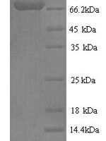Human Fucose-1-phosphate guanylyltransferase (FPGT) Recombinant Protein - BioCrest Sci