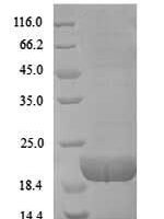Bovine T-cell surface glycoprotein CD8 alpha chain (CD8A), partial Recombinant Protein, N-His - BioCrest Sci