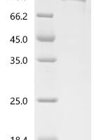 Human TRMT1-like protein (TRMT1L) Recombinant Protein - BioCrest Sci