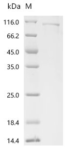 Human TRMT1-like protein (TRMT1L) Recombinant Protein, Homo sapiens (Human), E.coli, C-terminal 6xHis-tagged, 88.7 kDa, purity >≥ 85% as determined by SDS-PAGE.