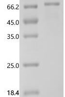 Human 3-phosphoinositide-dependent protein kinase 1 (PDPK1) Recombinant Protein, C-His - BioCrest Sci