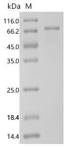 Human 3-phosphoinositide-dependent protein kinase 1 (PDPK1) Recombinant Protein, C-His, Homo sapiens (Human), E.coli, C-terminal 6xHis-tagged, 70.1 kDa, purity >≥ 90% as determined by SDS-PAGE.