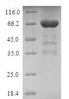 Human Tropomodulin-3 (TMOD3) Recombinant Protein - BioCrest Sci