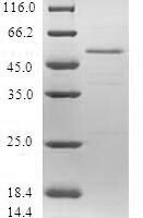 Human Protein SSX5 (SSX5) Recombinant Protein - BioCrest Sci
