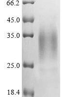 Human DNA dC->dU-editing enzyme APOBEC-3A (APOBEC3A) Recombinant Protein - BioCrest Sci