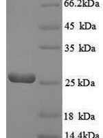 Escherichia coli GTP cyclohydrolase-2 (ribA) Recombinant Protein - BioCrest Sci