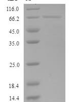 Human KeRatin, type I cuticular Ha5 (KRT35) Recombinant Protein - BioCrest Sci