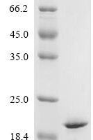 Human Serum amyloid A-2 protein (SAA2) Recombinant Protein - BioCrest Sci