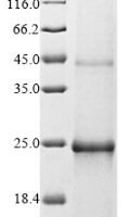 Epstein-Barr virus Secreted protein BARF1 (BARF1) Recombinant Protein, N-His - BioCrest Sci