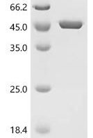 Escherichia coli O17:K52:H18 Chorismate synthase (aroC) Recombinant Protein - BioCrest Sci