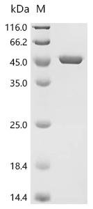 Escherichia coli O17:K52:H18 Chorismate synthase (aroC) Recombinant Protein, Escherichia coli O17:K52:H18 (strain UMN026 / ExPEC), E.coli, C-terminal 6xHis-tagged, 46.1 kDa, purity >≥ 95% as determined by SDS-PAGE.