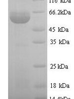Human Protein disulfide-isomerase (P4HB) Recombinant Protein - BioCrest Sci
