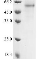 Human Cocaine esterase (CES2) Recombinant Protein - BioCrest Sci