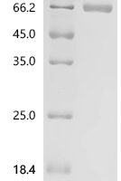 Rat Tonin (Klk2) Recombinant Protein, C-hFc1 - BioCrest Sci