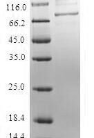Human Mannose-6-phosphate isomerase (MPI) Recombinant Protein - BioCrest Sci