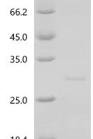 Mouse Interferon epsilon (Ifne) Recombinant Protein, N-His, aa 22–192, E.coli - BioCrest Sci
