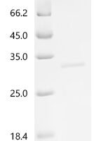Human Chymotrypsin-C (CTRC) Recombinant Protein - BioCrest Sci