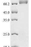 Macrovipera lebetina Chymotrypsin-like protease VLCTLP Recombinant Protein, C-hFc1 - BioCrest Sci