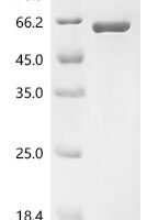 Human Adenylyl cyclase-associated protein 1 (CAP1) Recombinant Protein - BioCrest Sci