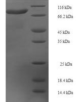 Human Kelch-like protein 36 (KLHL36) Recombinant Protein - BioCrest Sci