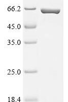 Escherichia coli Periplasmic trehalase (treA) Recombinant Protein - BioCrest Sci