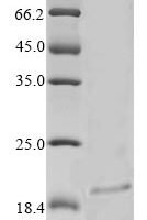 Rabbit Tumor necrosis factor ligand superfamily member 4 (TNFSF4), partial Recombinant Protein - BioCrest Sci