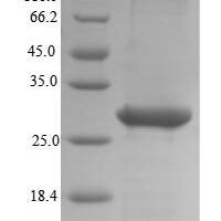 Human Embryonic stem cell-related gene protein (HESRG) Recombinant Protein - BioCrest Sci