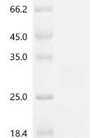 Bovine Interleukin-17A (IL17A) Recombinant Protein, N-His - BioCrest Sci