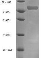 Human NADPH:adrenodoxin oxidoreductase, mitochondrial (FDXR) Recombinant Protein - BioCrest Sci