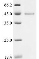Human Guanine nucleotide-binding protein G(k) subunit alpha (GNAI3) Recombinant Protein - BioCrest Sci