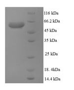 Mouse Multidrug resistance protein 3 (Abcb4), partial Recombinant Protein - BioCrest Sci